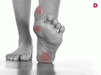 Вальгус или шишки на ногах: причины возникновения